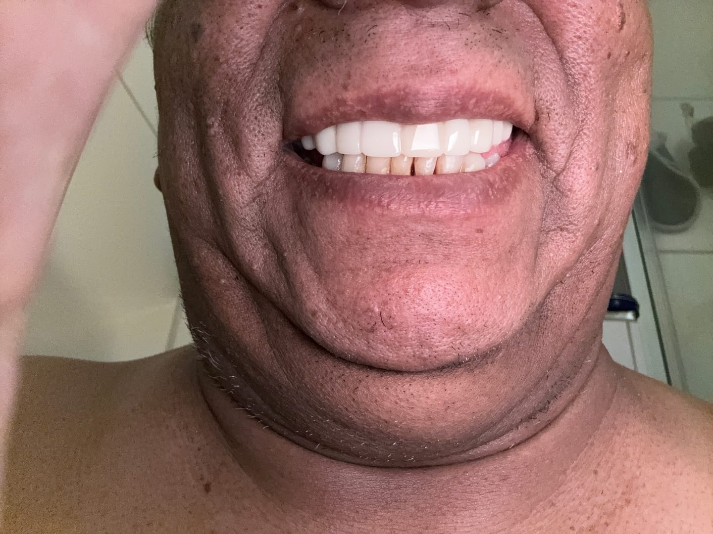 Snap On False Teeth Upper + Lower Dental Instant Veneers Dentures Tooth Cover White | Natural Look photo review
