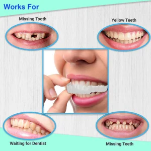Trevane Unisex Snap-On Veneers  | Natural Look | Instant Smile | BPA-Free| 1 pair (Uper and lower) photo review