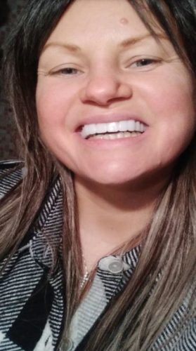 Trevane Unisex Snap-On Veneers  | Natural Look | Instant Smile | BPA-Free| 1 pair (Uper and lower) photo review